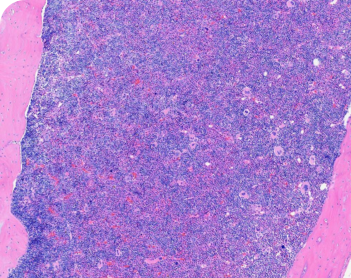 Wound Healing | Therapeutic Areas